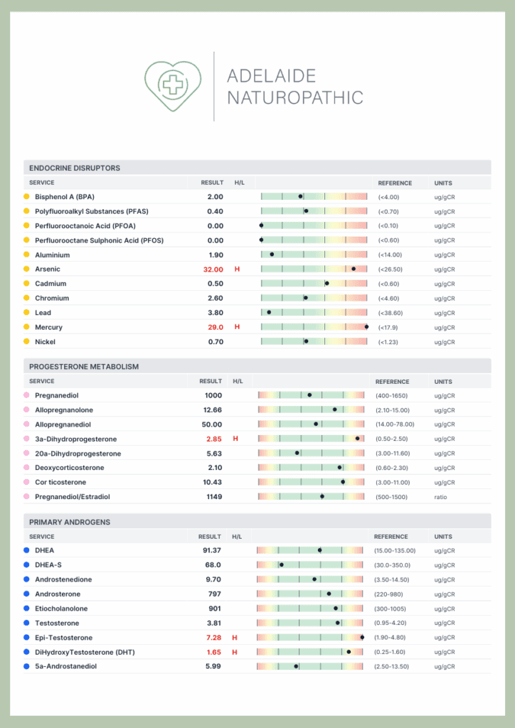 Adelaide DUTCH testing 3