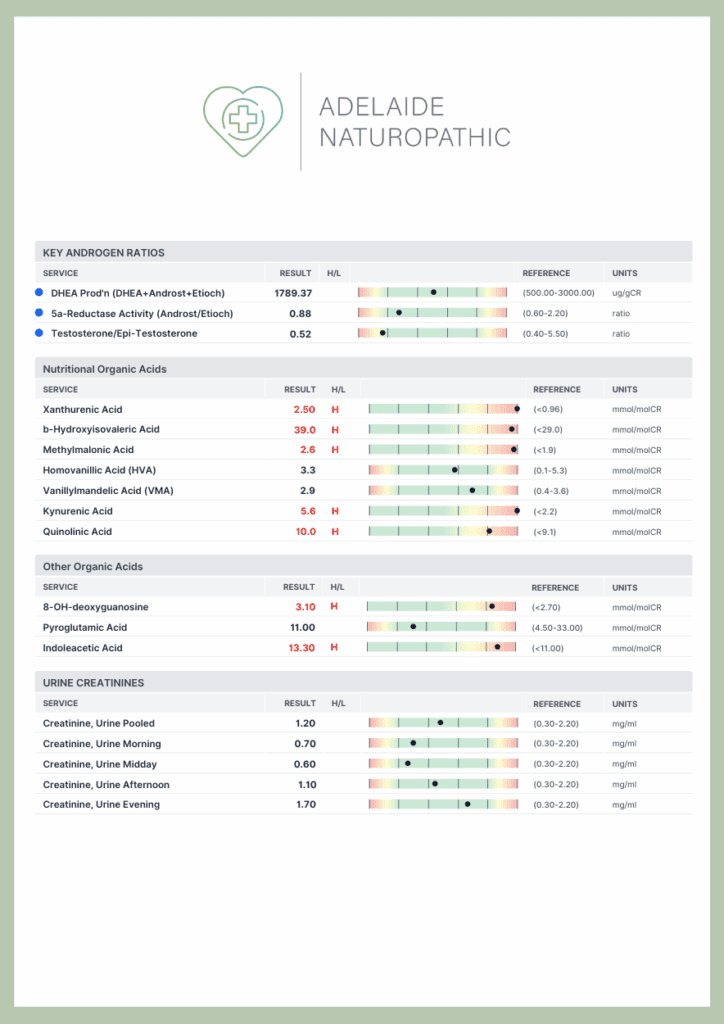 Adelaide DUTCH testing 4